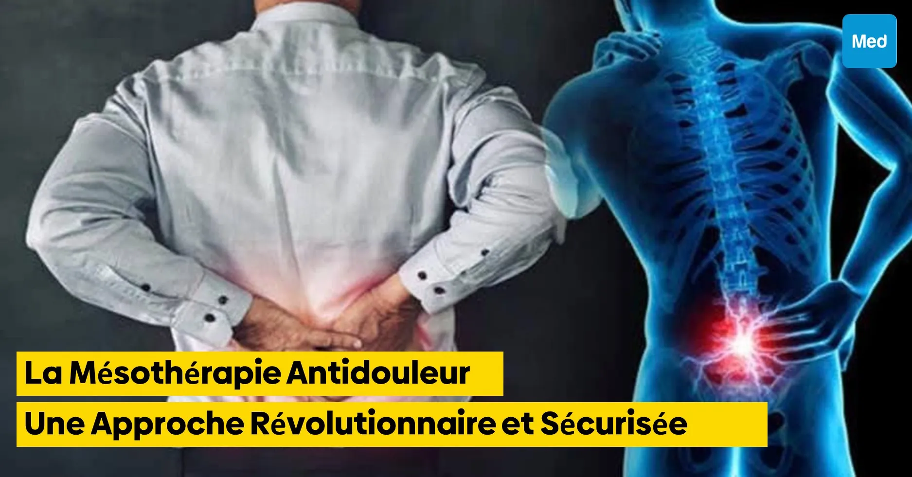 La Mésothérapie Antidouleur : Une Approche Révolutionnaire et Sécurisée